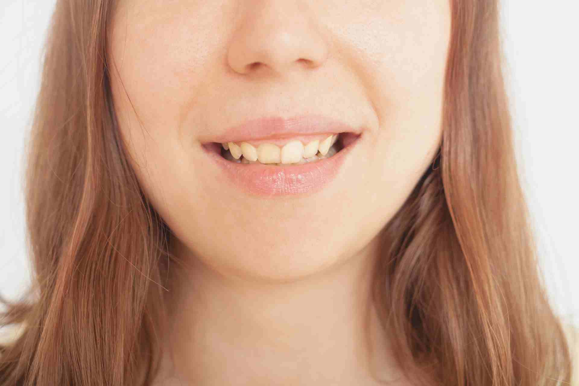 Why Is My Teeth Yellow Even Though I Brush Every Day?