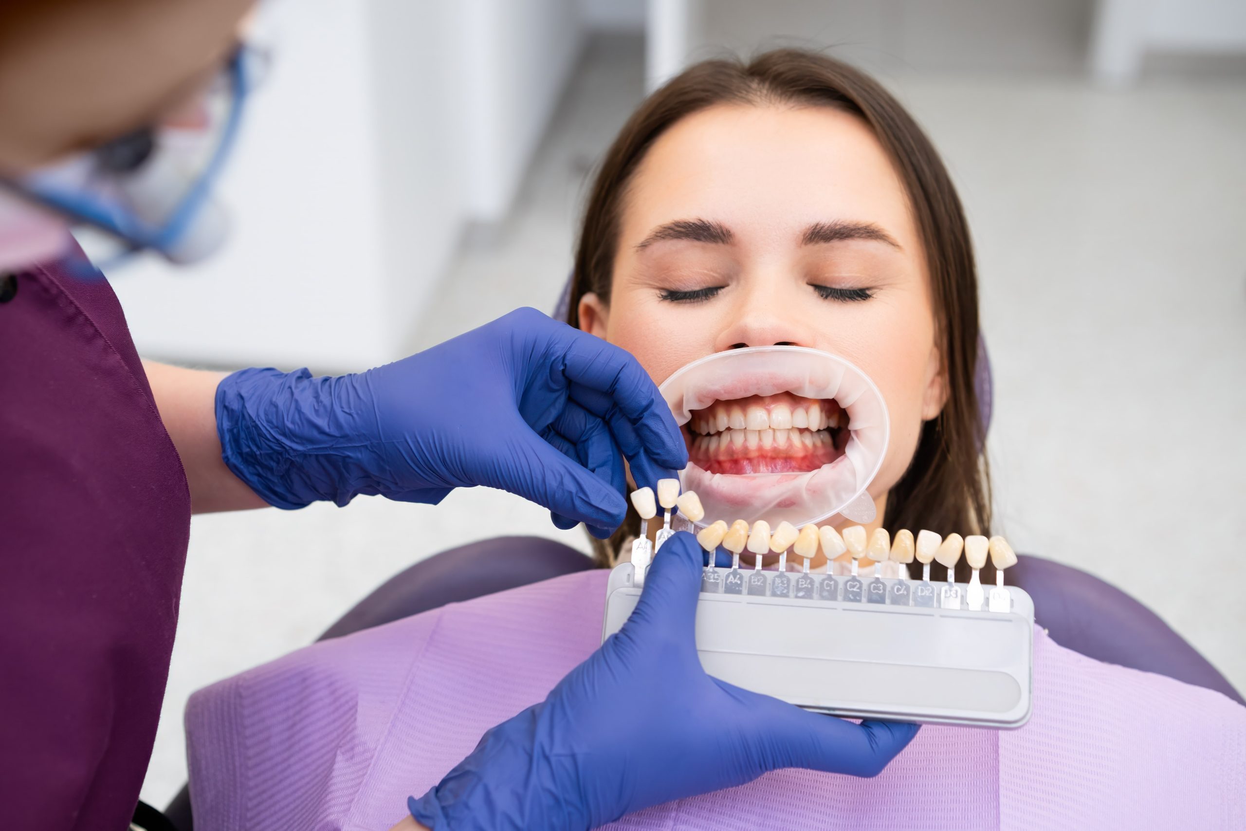 Are Veneers Bad for Your Teeth?