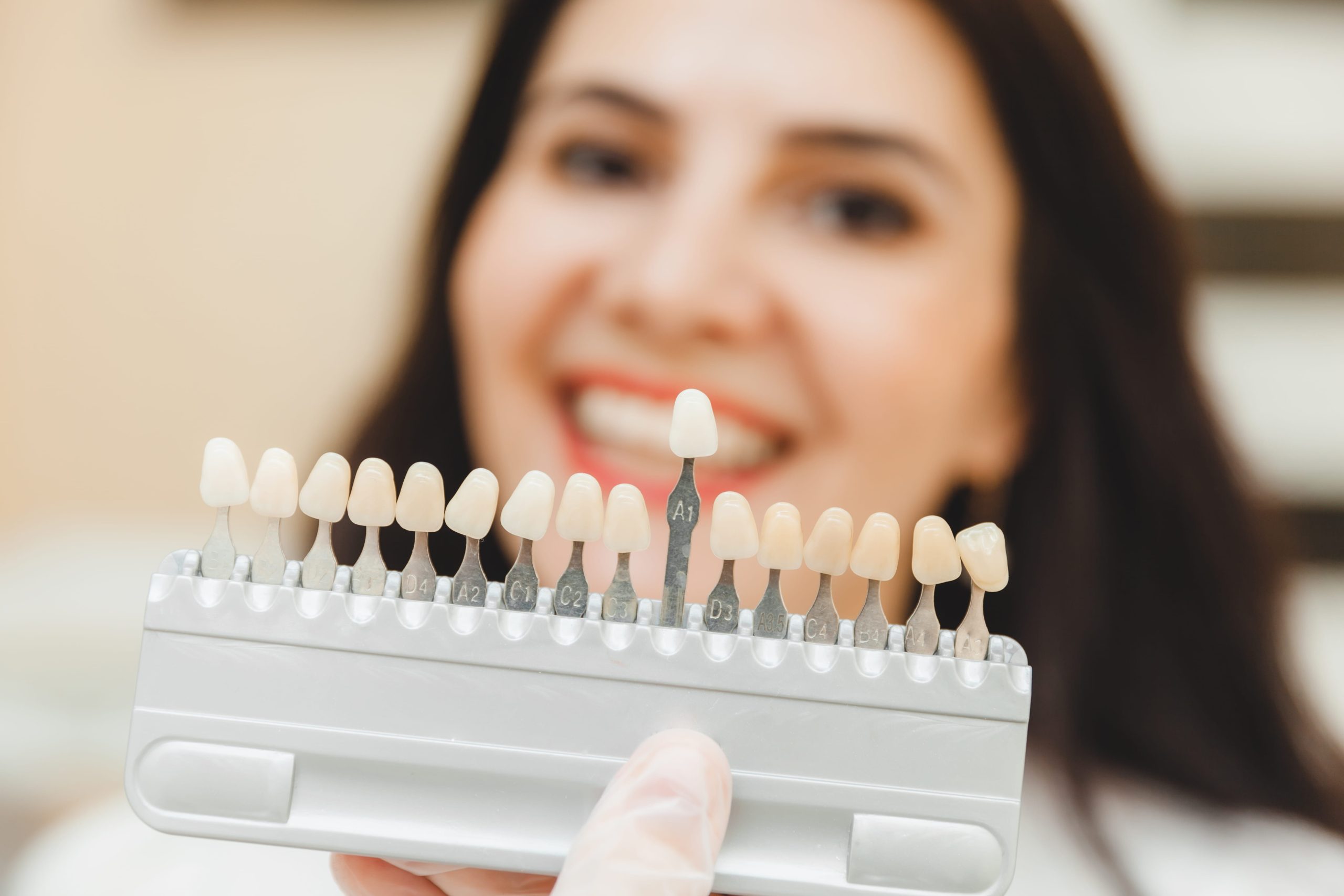 Are Veneers Permanent?