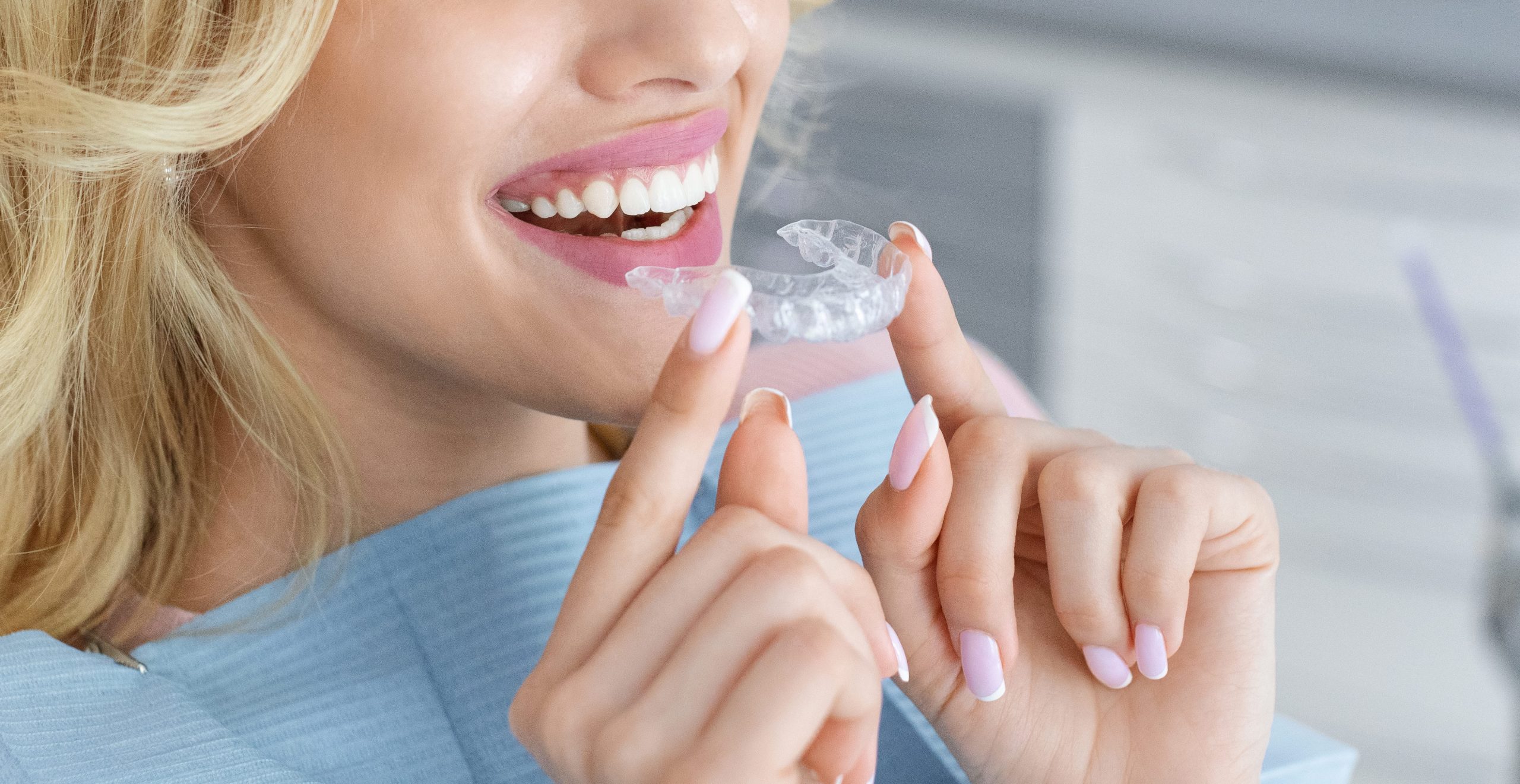 How Long Does Invisalign Take?