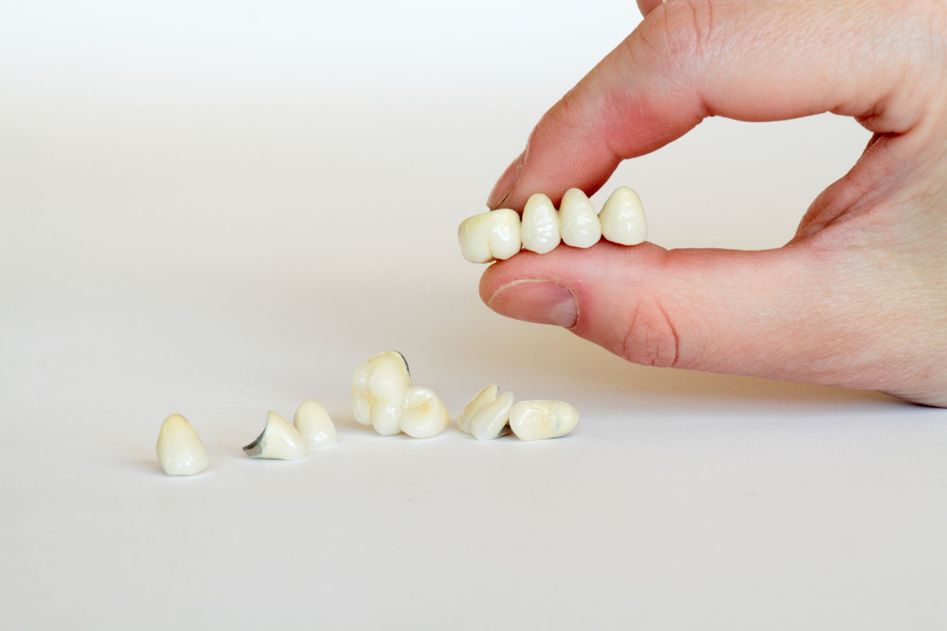 Crown vs Bridge After a Tooth Extraction: Which One You Need and How Long Each Lasts